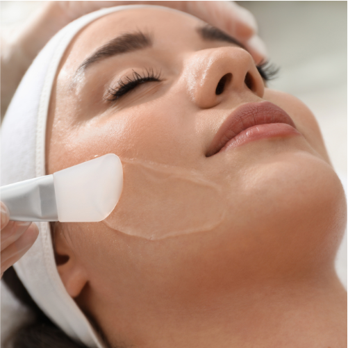 Peeling para acne precio Queretaro